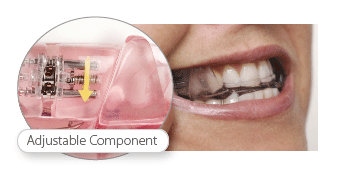 Image of a patient wearing the adjustable component